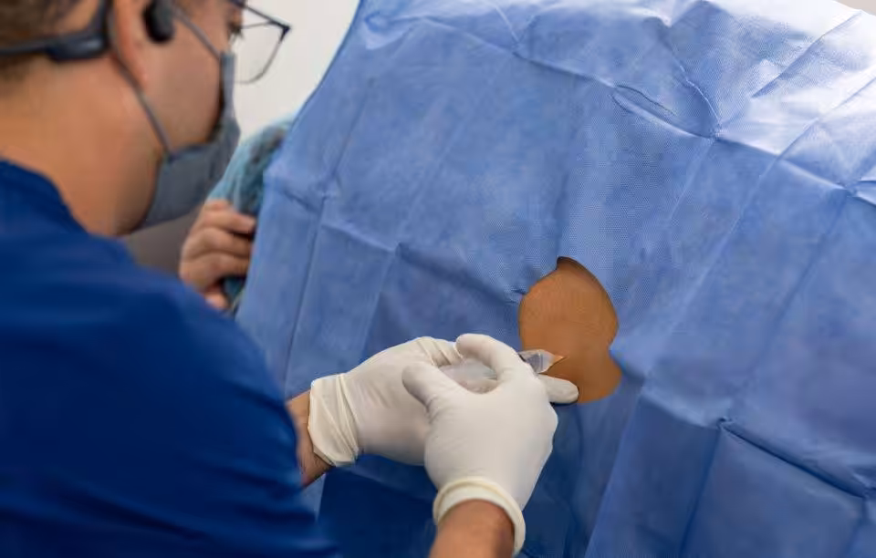 epidural injection