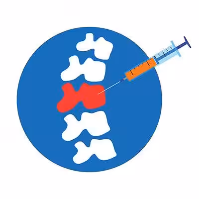 Illustration of an injection being administered into a highlighted red section of a spinal column within a blue circle.